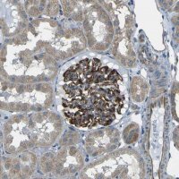 Anti-SLK antibody produced in rabbit 