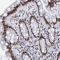 Anti-SLTM antibody produced in rabbit 