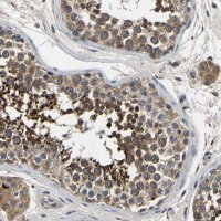 Anti-SMPD2 antibody produced in rabbit 