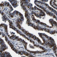 Anti-SMPD2 antibody produced in rabbit 