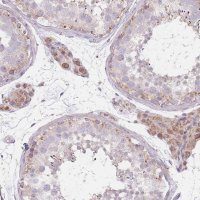 Anti-SMPD4 antibody produced in rabbit 