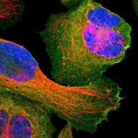 Anti-SNAP23 antibody produced in rabbit 
