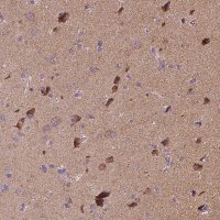 Anti-SNCAIP antibody produced in rabbit 