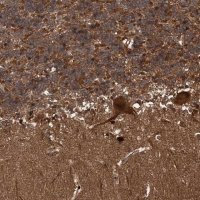 Anti-SNRNP25 antibody produced in rabbit 