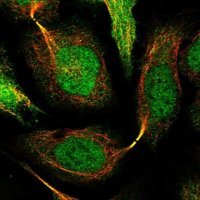 Anti-SNRNP25 antibody produced in rabbit 