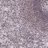 Anti-SNRNP70 antibody produced in rabbit 