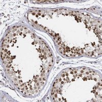 Anti-SNRPC antibody produced in rabbit 
