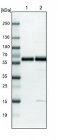 Anti-SNTB2 antibody produced in rabbit HPA001394-100UL