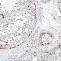 Anti-SNU13 antibody produced in rabbit