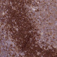 Anti-SNX21 antibody produced in rabbit 