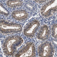 Anti-SOCS5 antibody produced in rabbit 