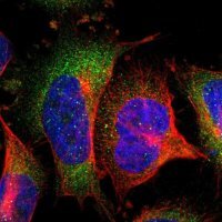 Anti-SOCS7 antibody produced in rabbit