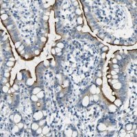 Anti-SORCS1 antibody produced in rabbit 