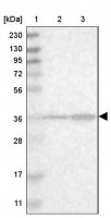 Anti-SPATC1L antibody produced in rabbit HPA019165-100UL