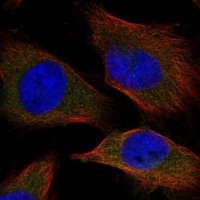 Anti-SPC25 antibody produced in rabbit 