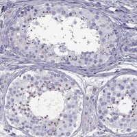 Anti-SPDYE1 antibody produced in rabbit HPA051750-100UL