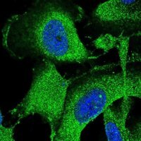 Anti-SPG11 antibody produced in rabbit 