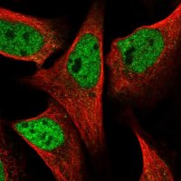 Anti-SPIDR antibody produced in rabbit