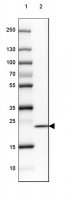 Anti-SPINK13 antibody produced in rabbit 