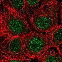 Anti-SPRYD4 antibody produced in rabbit HPA053469-100UL