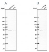 Anti-SPTLC1 antibody produced in rabbit 