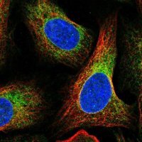 Anti-SPTLC1 antibody produced in rabbit 