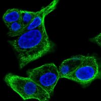 Anti-SPTLC3 antibody produced in rabbit 