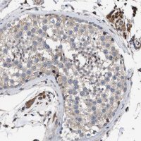 Anti-SQLE antibody produced in rabbit 