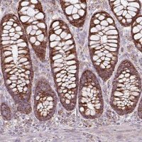 Anti-SQRDL antibody produced in rabbit 