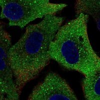 Anti-SQSTM1 antibody produced in rabbit HPA064165-100UL