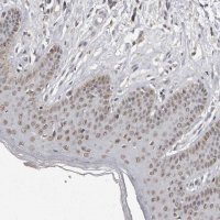 Anti-SRCAP antibody produced in rabbit 