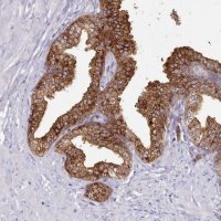 Anti-SRD5A1 antibody produced in rabbit 