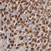 Anti-SRD5A3 antibody produced in rabbit 