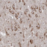 Anti-SRPX2 antibody produced in rabbit HPA038786-100UL