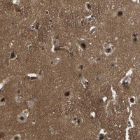 Anti-SRRM3 antibody produced in rabbit 