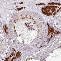 Anti-SRRM5 antibody produced in rabbit 