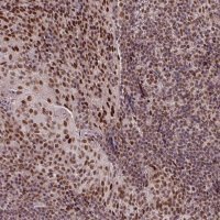 Anti-SRSF2 antibody produced in rabbit HPA049905-100UL