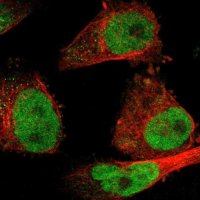 Anti-SSB antibody produced in rabbit 