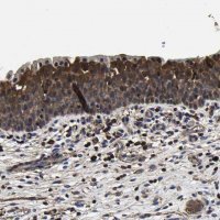Anti-SSH3 antibody produced in rabbit