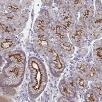 Anti-SSTR1 antibody produced in rabbit 