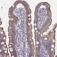 Anti-SSTR1 antibody produced in rabbit 