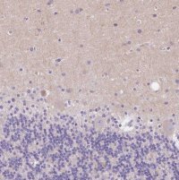 Anti-SSTR4 antibody produced in rabbit 