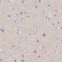 Anti-SSTR4 antibody produced in rabbit 