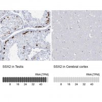 Anti-SSX2 antibody produced in rabbit 
