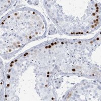 Anti-SSX2 antibody produced in rabbit 