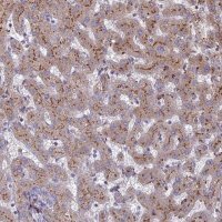Anti-ST3GAL6 antibody produced in rabbit 