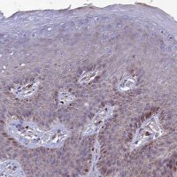 Anti-ST3GAL6 antibody produced in rabbit 