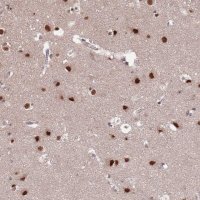 Anti-ST5 antibody produced in rabbit 
