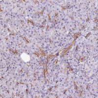 Anti-ST7 antibody produced in rabbit 