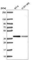 Anti-ST8SIA4 antibody produced in rabbit HPA053995-100UL